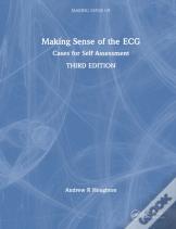 Making Sense Of The Ecg