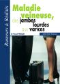 Maladie Veineuse, Des Jambes Lourdes Aux Varices - Preview
