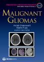 Malignant Gliomas - Preview