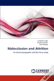 Capa do artigo Malocclusion And Attrition