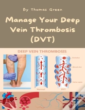 Capa do artigo Manage Your Deep Vein Thrombosis (Dvt)