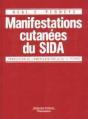 Manifestations Cutanees Du Sida - Preview