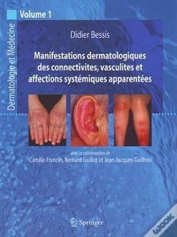 Capa do artigo Manifestations Dermatologiques De Collectivites, Vasculites Et Affections Systémiques Apparentées