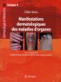 Manifestations Dermatologiques Des Maladies D'Organe - Preview