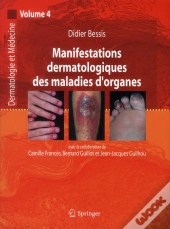 Manifestations Dermatologiques Des Maladies D'Organe