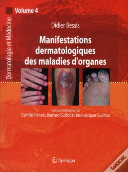 Capa do artigo Manifestations Dermatologiques Des Maladies D'Organe