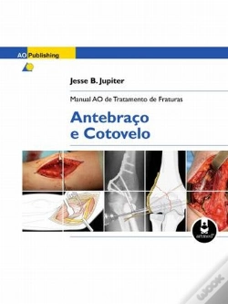 Capa do artigo Manual AO de Tratamento de Fraturas