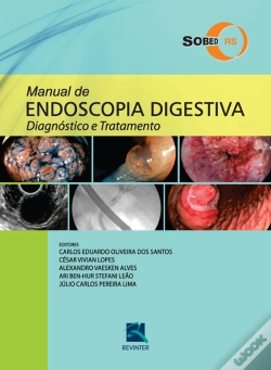 Capa do artigo Manual De Endoscopia Digestiva – Sobed/Rs