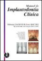 Manual de Implantodontia Clínica - Preview