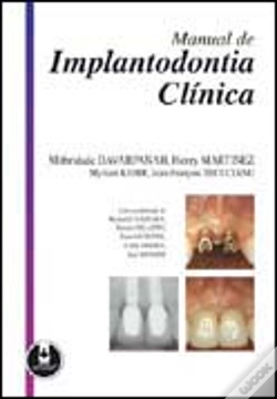 Capa do artigo Manual de Implantodontia Clínica