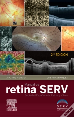 Capa do artigo Manual De Retina Serv (2ª Ed.)