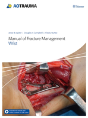 Manual Of Fracture Management - Wrist - Preview