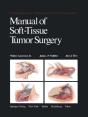 Manual Of Soft-Tissue Tumor Surgery - Preview