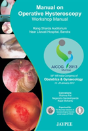 Manual On Operative Hysteroscopy - Preview