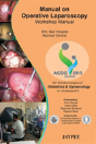 Manual On Operative Laparoscopy: Workshop Manual - Preview
