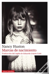 Marcas De Nacimiento
