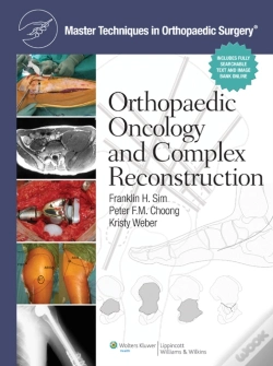 Capa do artigo Master Techniques In Orthopaedic Surgery: Orthopaedic Oncology And Complex Reconstruction