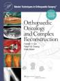 Master Techniques In Orthopaedic Surgery: Orthopaedic Oncology And Complex Reconstruction - Preview