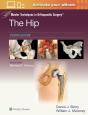 Master Techniques In Orthopaedic Surgery: The Hip: Print + Ebook With Multimedia - Preview