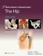 Master Techniques In Orthopaedic Surgery: The Hip - Preview