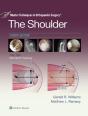 Master Techniques In Orthopaedic Surgery: The Shoulder - Preview