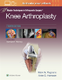 Master Techniques In Orthopedic Surgery: Knee Arthroplasty - Preview
