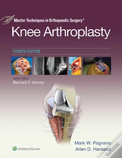 Capa do artigo Master Techniques In Orthopedic Surgery: Knee Arthroplasty