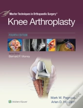 Master Techniques In Orthopedic Surgery: Knee Arthroplasty