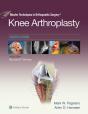 Master Techniques In Orthopedic Surgery: Knee Arthroplasty - Preview