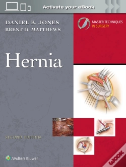 Capa do artigo Master Techniques In Surgery: Hernia: Print + Ebook With Multimedia