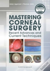Capa do artigo Mastering Corneal Surgery