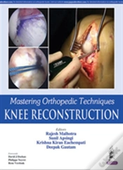 Capa do artigo Mastering Orthopedic Techniques: Knee Reconstruction