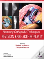 Capa do artigo Mastering Orthopedic Techniques: Revision Knee Arthroplasty
