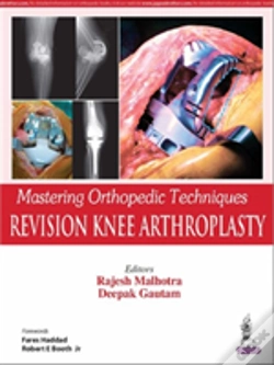 Capa do artigo Mastering Orthopedic Techniques: Revision Knee Arthroplasty