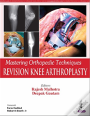 Mastering Orthopedic Techniques: Revision Knee Arthroplasty