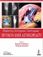 Mastering Orthopedic Techniques: Revision Knee Arthroplasty - Preview