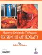Mastering Orthopedic Techniques: Revision Total Hip Arthroplasty - Preview