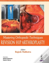 Mastering Orthopedic Techniques: Revision Total Hip Arthroplasty