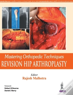 Capa do artigo Mastering Orthopedic Techniques: Revision Total Hip Arthroplasty