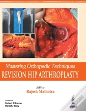 Capa do artigo Mastering Orthopedic Techniques: Revision Total Hip Arthroplasty