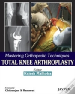 Capa do artigo Mastering Orthopedic Techniques: Total Knee Arthroplasty