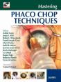 Mastering Phaco Chop Techniques - Preview