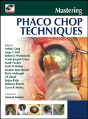 Mastering Phaco Chop Techniques - Preview