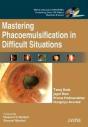Mastering Phacoemulsification In Difficult Situations - Preview