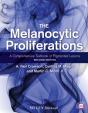 Melanocytic Proliferations - Preview