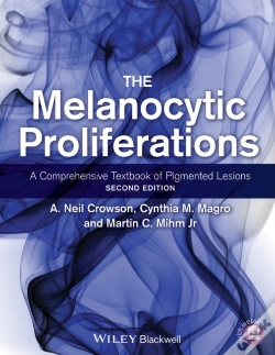 Capa do artigo Melanocytic Proliferations