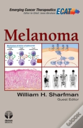 Melanoma