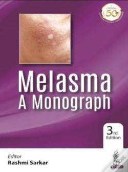 Capa do artigo Melasma: A Monograph
