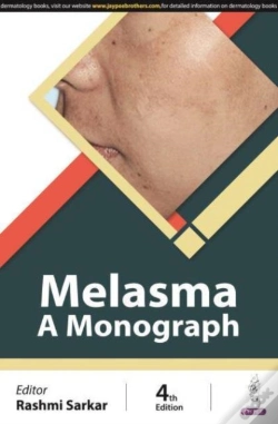 Capa do artigo Melasma
