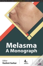 Capa do artigo Melasma